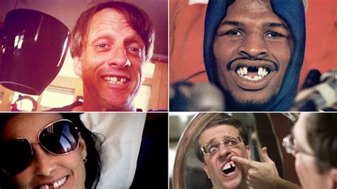 Charlie Sheen Jim Carrey Amy Winehouse Toothless Celebrity Smiles
