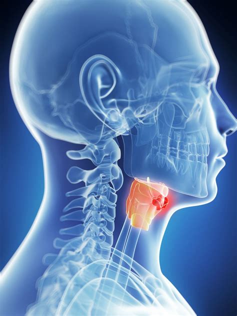 What Are The Signs Of Larynx Cancer Laryngeal Cancer Symptoms