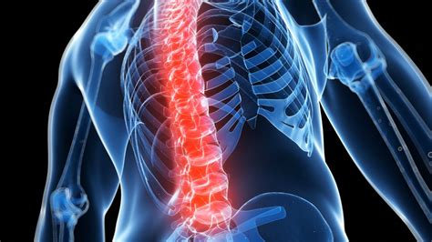 Comparing Surgical Approaches To Treat Spinal Synovial Cysts Johns
