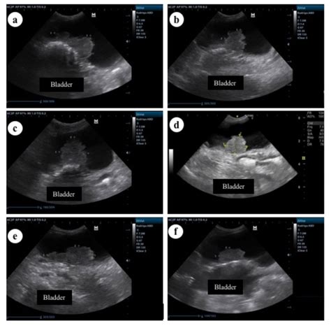 Ultrasonography Representative Of The Urinary Bladder From Dog 1 As