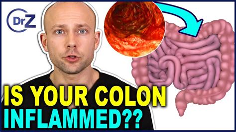 Colon Inflammation The Symptoms Dangerous Side Effects And How To