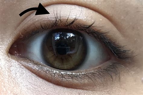 Eyelashes Growing Outside Of Eyelash Line Makeupaddiction
