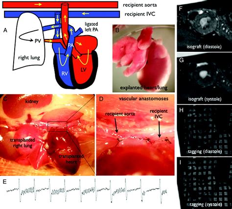 Mri Of A Novel Murine Working Heart Transplant Model Circulation