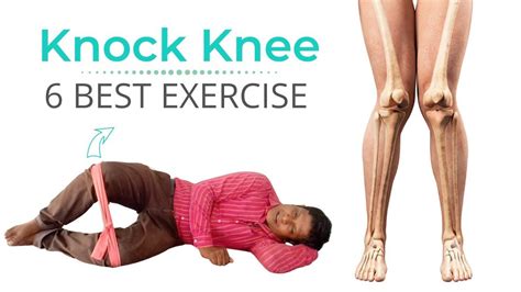 Knock Knees Exercises Knee Exercises Knock Knees Correction Weight Loss Journey Workout