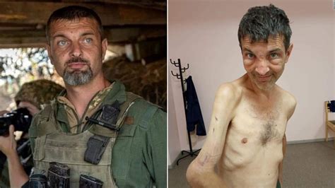 Mykhailo Dianov El Soldado Ucraniano Cuya Imagen Demacrada Se Viralizó