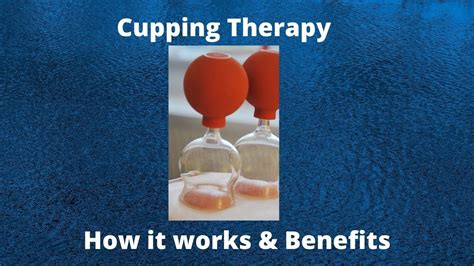 cupping therapy how it works and benefits youtube