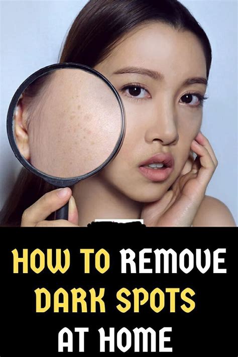 How To Get Rid Of Dark Spots On Face Overnight Remedies Dark Spots On
