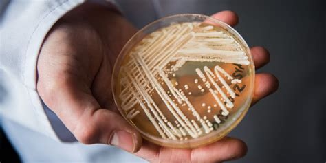 Deadly Drug Resistant Fungus Spreading In Us At Alarming Rate Cdc