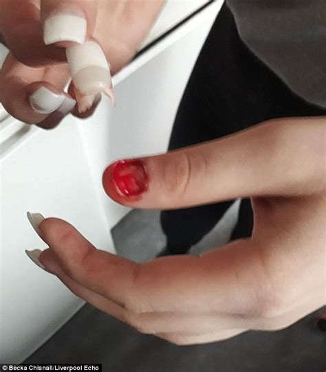 Teenager Reveals How She Ripped Off Her Thumbnail With Her Acrylics Daily Mail Online