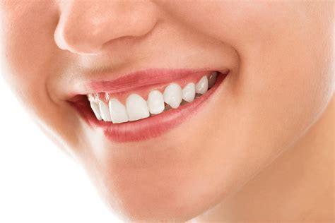 7 Simple Ways On How To Keep Your Gums Healthy