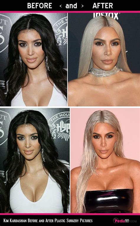 Kim Kardashian Face Pics Plastic Surgery Before And After Photo 3 Kim Kardashian Before