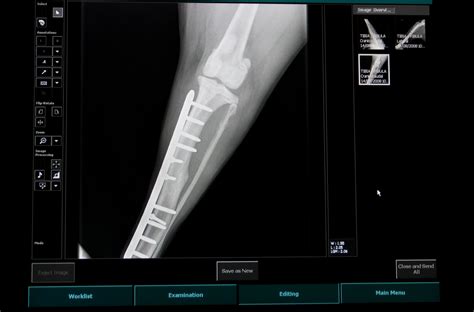 Dicom viewer free for windows. Seeking a DICOM Viewer for Windows? Read these Tips and ...