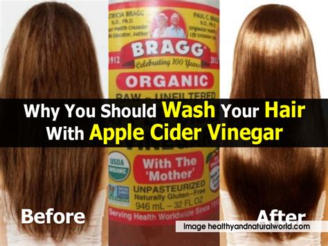 Why You Should Wash Your Hair With Apple Cider Vinegar