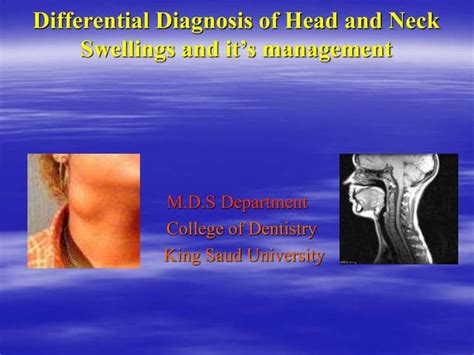 Differential Diagnosis Of Neck Swellings