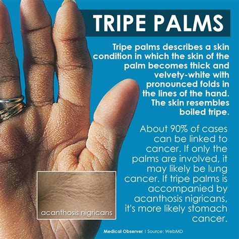 Tripe Palm Tripe Skin Conditions Cancer