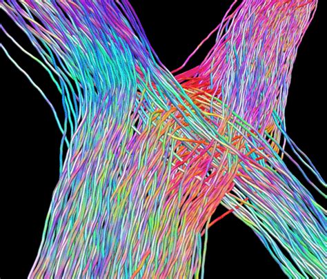 These Psychedelic S Show The Future Of Brain Mapping