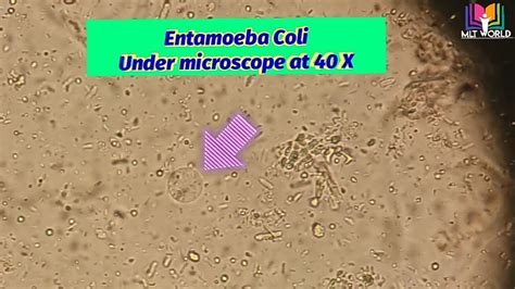 Ecoli Under Microscope Entamoeba Coli Parasite In Stool Microscopye