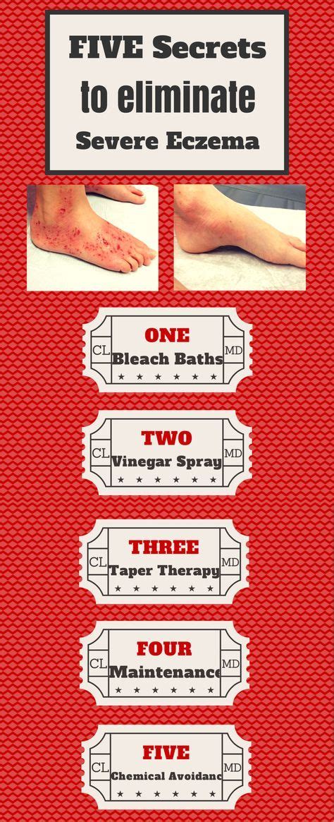 Pin on Healthy Tips