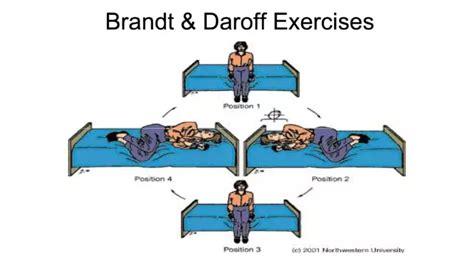 Learn How To Perform The Brandt Daroff To Treat Benign Paroxysmal