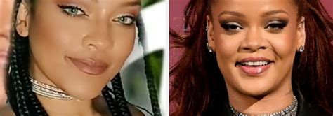 Rihanna Nose Job Before And After