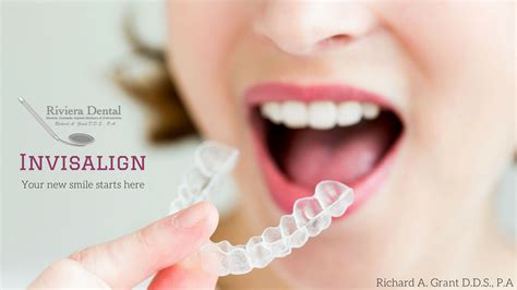 All You Want To Know About The Invisalign Aligners Professional