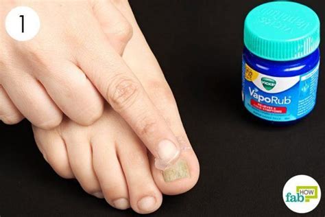 I had toenail fungus for years and nothing would fix it except for this. apply vicks vaporub on toenail fungus | Vicks for toenail ...