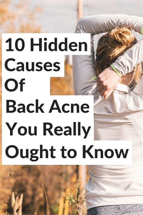 10 Hidden Causes Of Back Acne You Really Ought To Know Back Acne