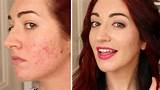 Pictures of How To Cover Up Dark Spots With Makeup