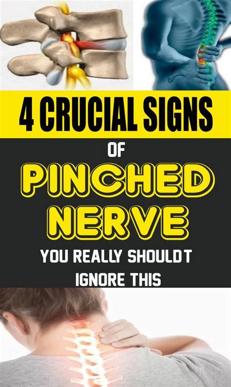 Health Medicine 4 Crucial Signs Of A Pinched Nerve You Really Should’t Ignore