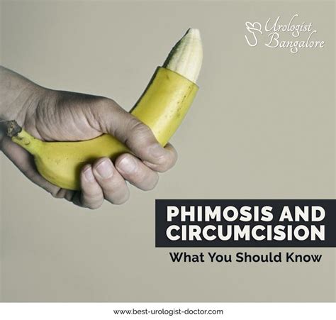 Phimosis Will Usually Go Away On Its Own On At The First Few Years Of A