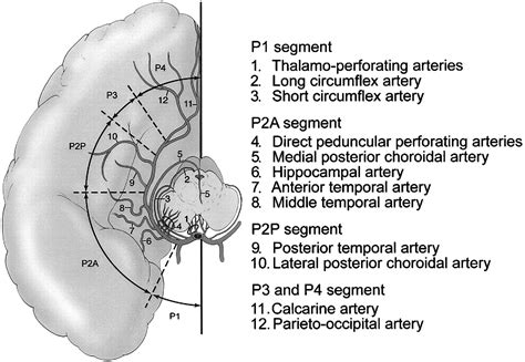 Aneurysms Of The Posterior Cerebral Artery Classification And