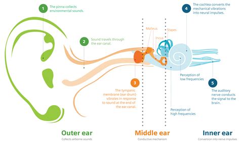 Conductive Hearing Loss Diagram