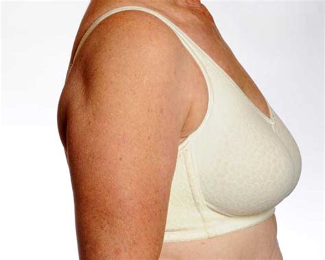 External Breast Prostheses Cancer Australia