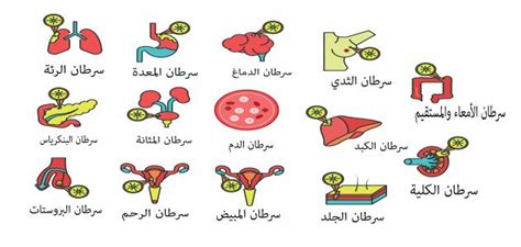 أنواع مرض السرطان موضوع