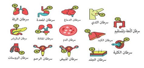 اسماء مرض السرطان