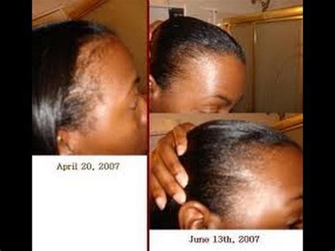 I'm so pleased with the results and how the company doesn't cut corners. Super Potent Jamaican Black Castor Oil - YouTube