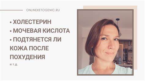 Диета для снижения мочевая кислота Кето диета. Мочевая кислота. Холестерин. - YouTube Кето диета. Мочевая кислота. Холестерин. - YouTube Диета для снижения мочевая кислота