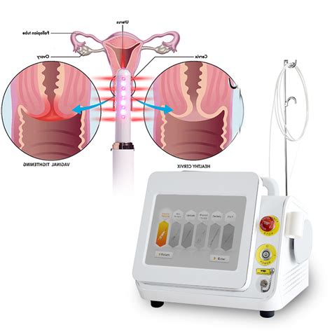 Diode Laser Vaginal Tightening Nm Gynecological Laser Women