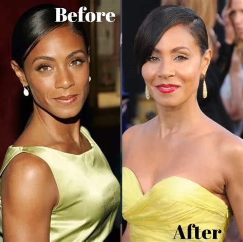 Jada Pinkett Smiths Plastic Surgery Journey Vanity