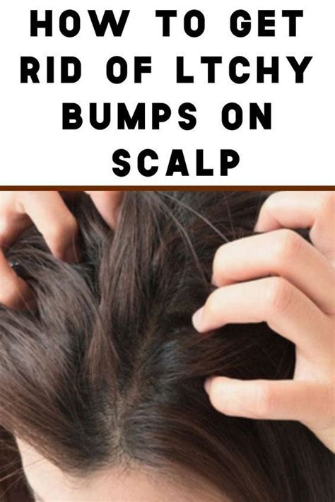 What Causes Itchy Bumps On Scalp And How You Can Get Rid Of Them Dry