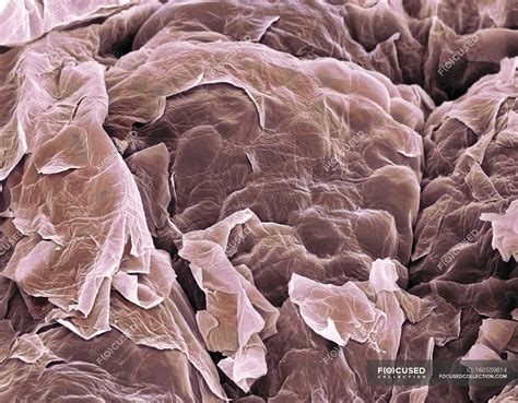 Coloured Scanning Electron Micrograph Sem Of Squamous Epithelial