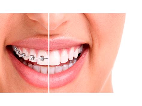 5 de arte y ensayo (cinema paraiso) estan muy cerca en. DENTISTA NO BAIRRO ADRIANA CAMPO GRANDE - RJ
