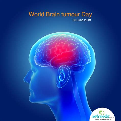 World Brain Tumour Day Never Ignore Warning Signs Netmeds