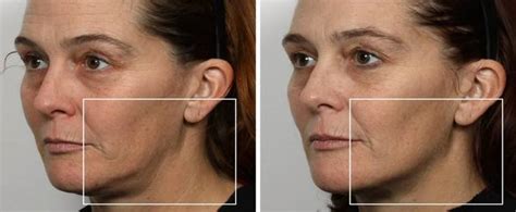 Which Nuface Facial Toning Device Is Right For Me Lookfantastic Uk