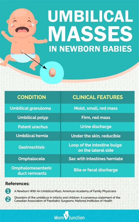 Umbilical Granuloma In Babies Causes Treatment And Care