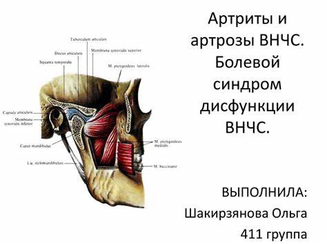 Артриты артрозы диета Артриты и артрозы ВНЧС. Болевой синдром дисфункции ВНЧС - online Артриты и артрозы ВНЧС. Болевой синдром дисфункции ВНЧС - online Артриты артрозы диета