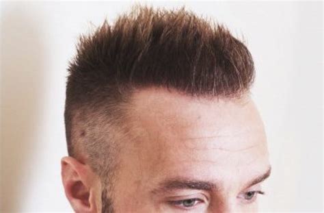 May 28, 2019 · her study of streaking leads to a plan; Is Hair Transplant Dangerous?