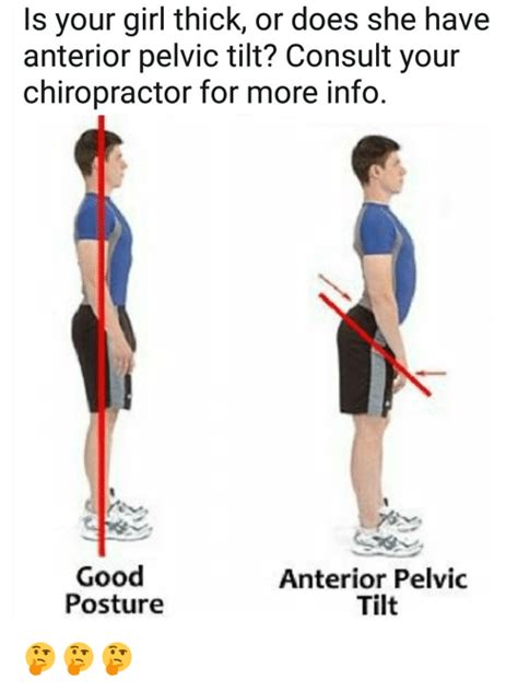 Is Your Girl Thick Or Does She Have Anterior Pelvic Tilt