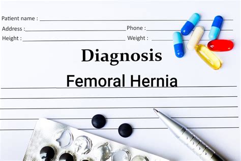 Femoral Hernia Diagnosis