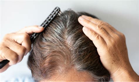 The dosage of spironolactone depends on the purpose it is being used for. The one pill that treats hair loss, heart failure, and more